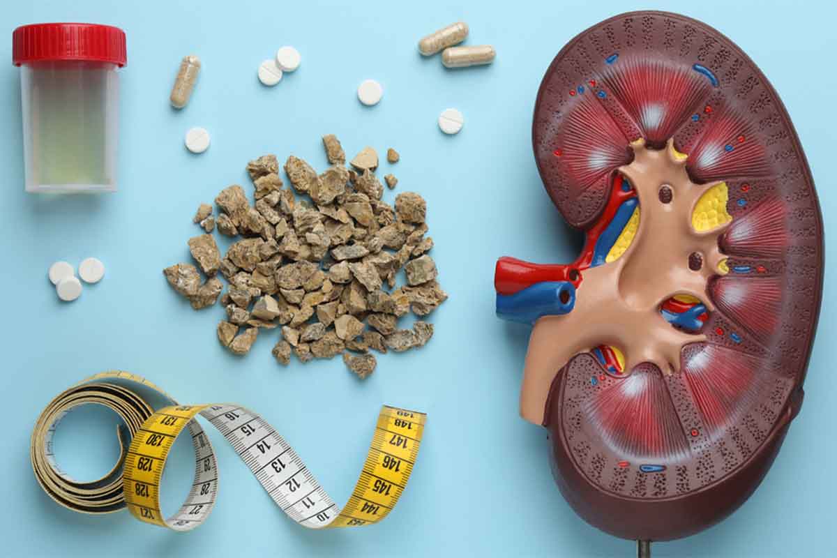 سنگ شکنی کلیه با ESWL